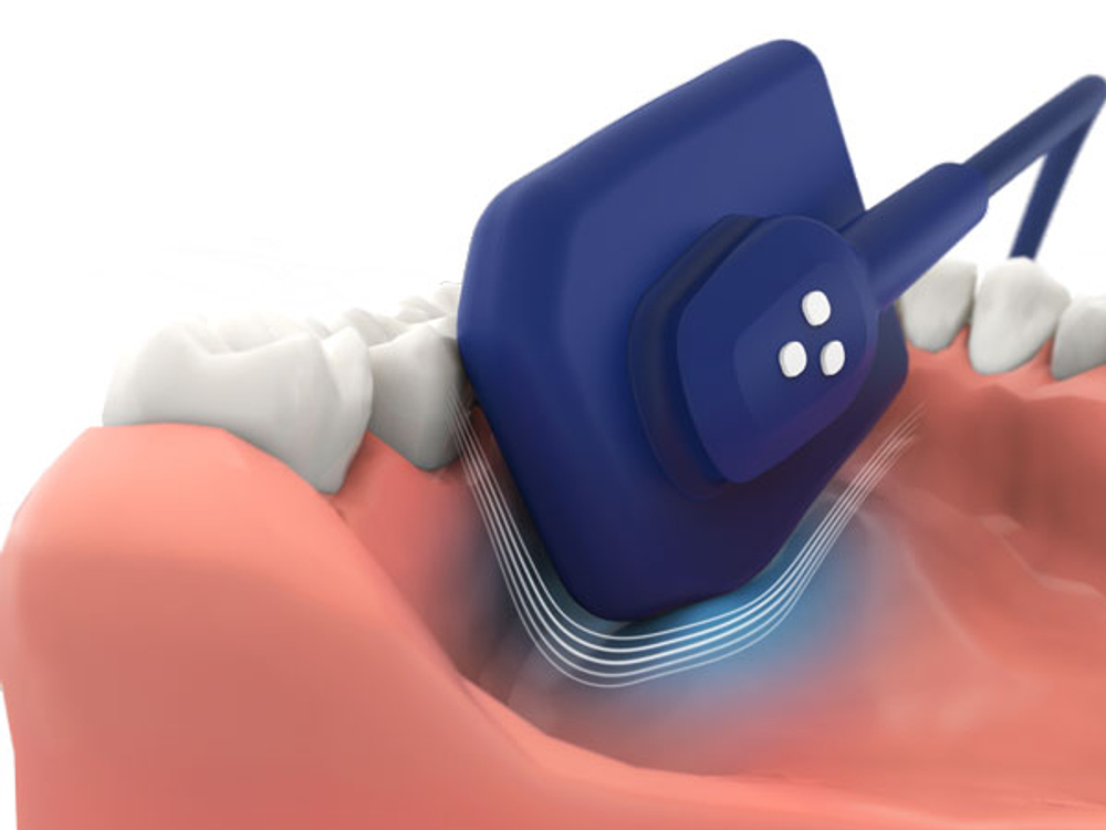 Радиовизиограф EzSensor Soft