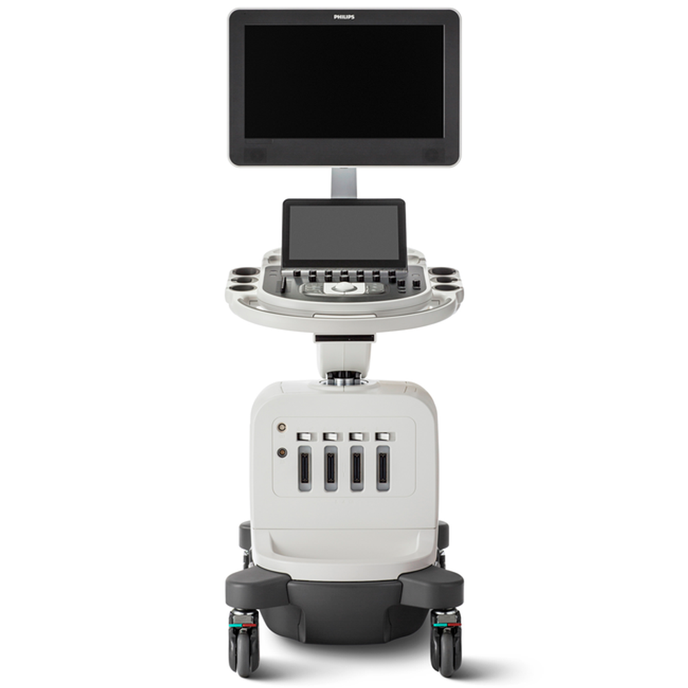 Ультразвуковая диагностическая система Philips Affiniti 50