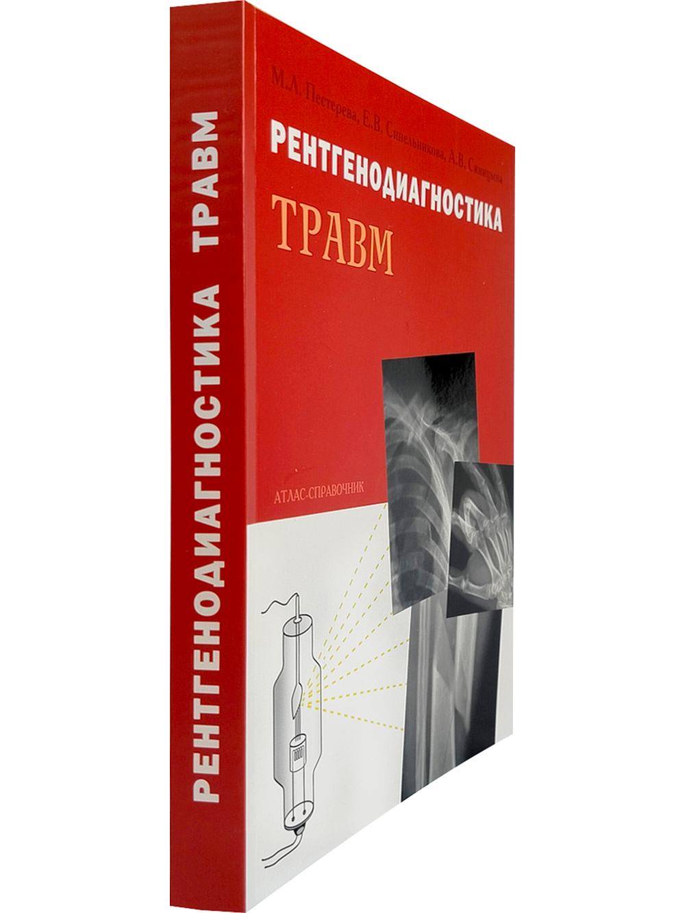 Рентгенодиагностика травм