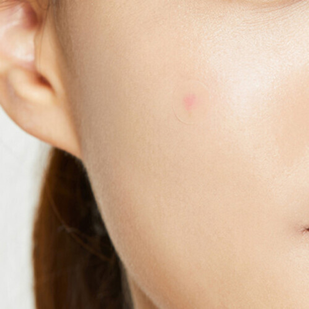 Cosrx Патчи против акне прозрачные - Acne pimple master patch, 24шт
