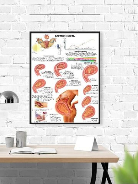 Обучающий медицинский плакат "Беременность" 600*900 мм