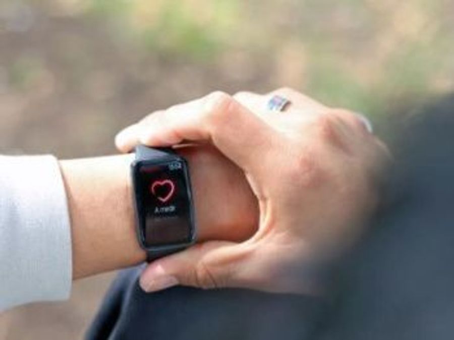 Появились первые рендеры дизайна фитнес-браслета Xiaomi Smart Band 9 Active