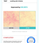Крем с 5% азелаиновой икслотой SKIN&LAB Azelaic acid balancung moisturizer, 100мл