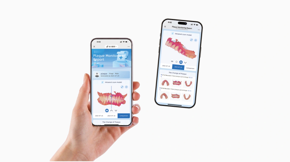 Интраоральный сканер Shining Elf – НОВИНКА