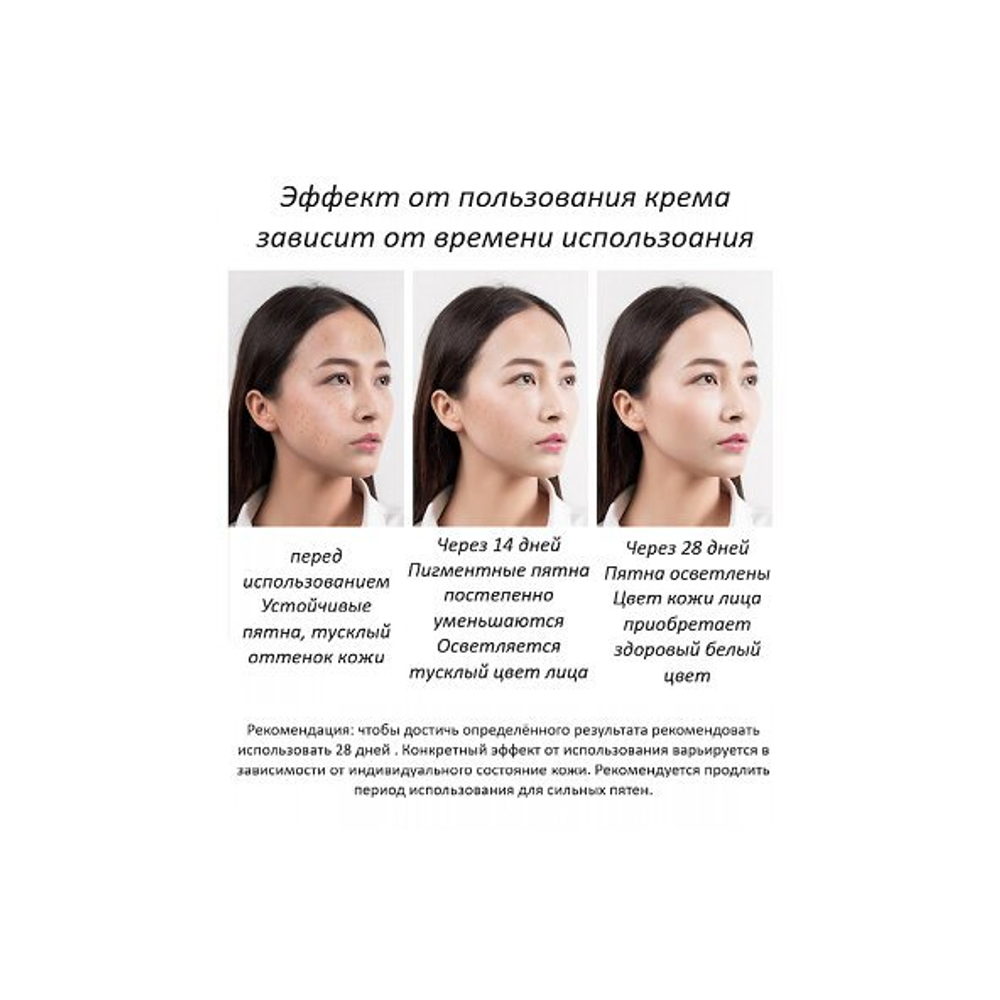 Крем для лица Baizton Whitening отбеливающий от пигментных пятен 50