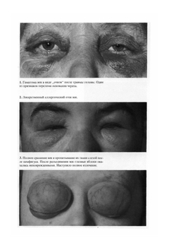 Атлас глазных болезней | Н.А. Пучковская