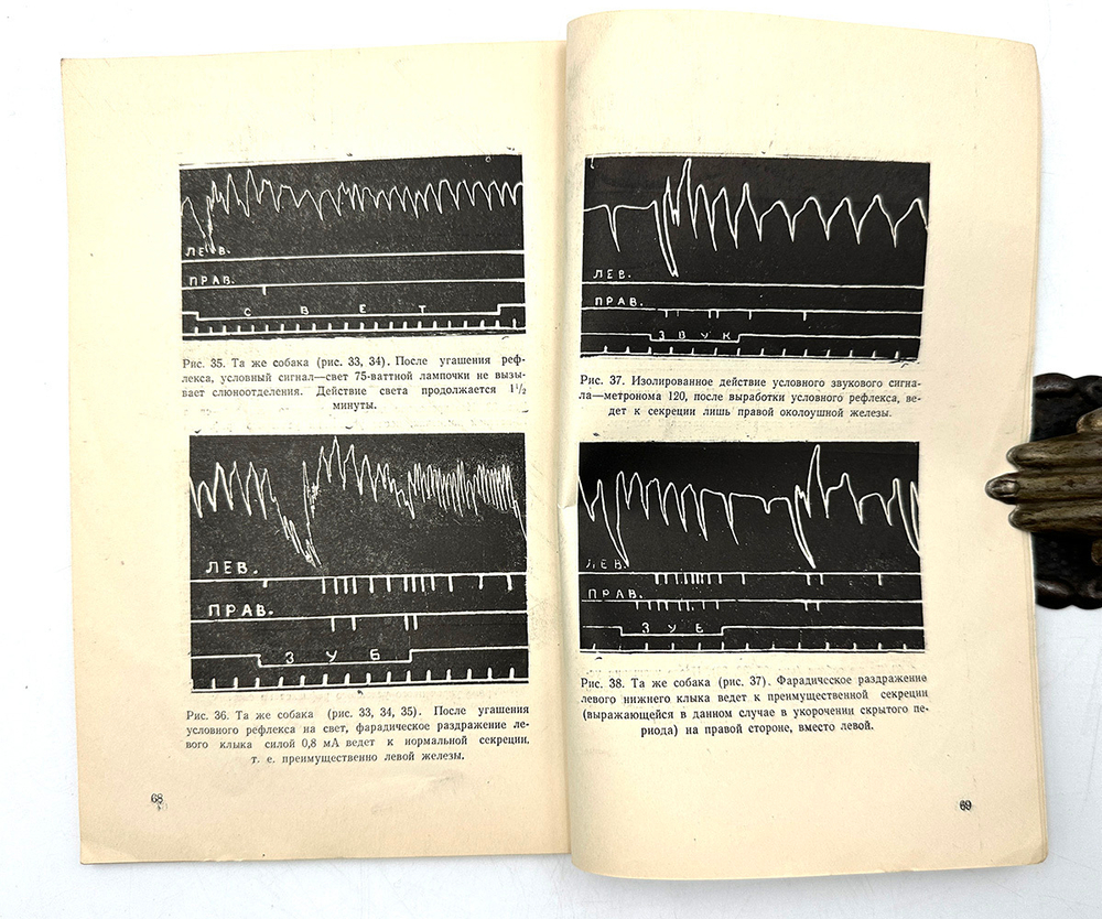 Гедеванишвили Д. М. (АВТОГРАФ) .О парной и раздельной работе больших полушарий головного мозга.1956г