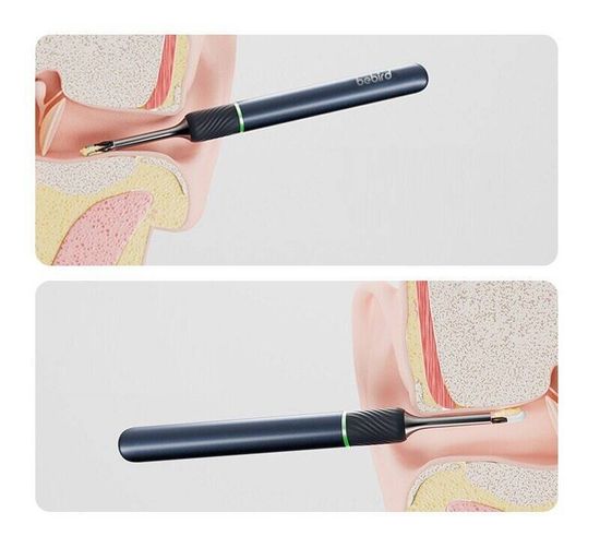 Умная ушная палочка Bebird Ear Visual Picking Stick Note 5 Pro