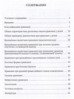 Кривошея у детей младшего возраста : учебное пособие