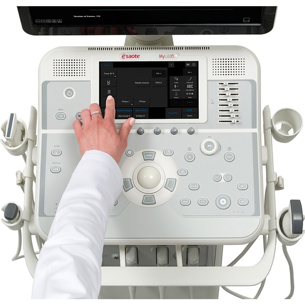 УЗИ аппарат Esaote MyLab X5