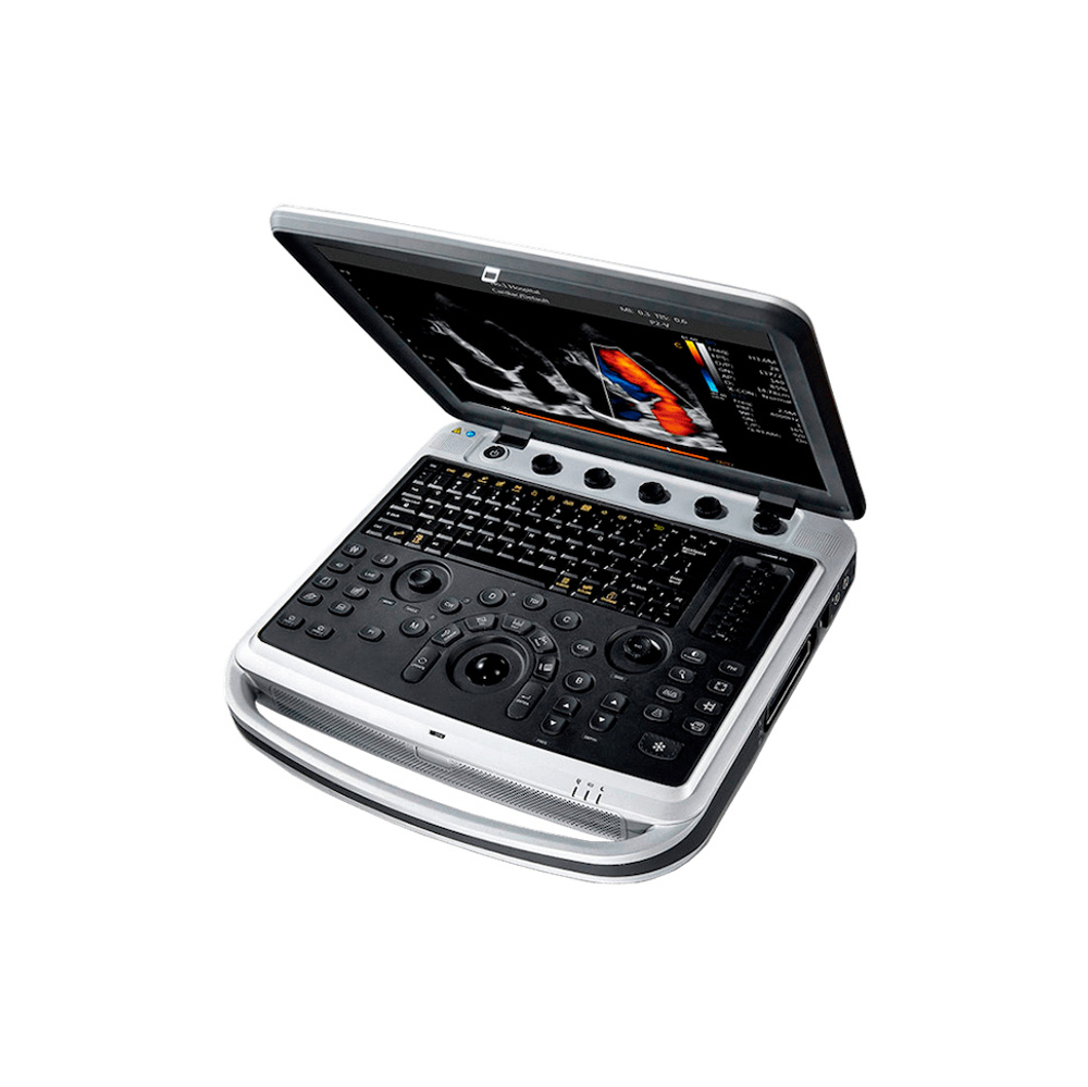 УЗИ аппарат CHISON SonoBook 9