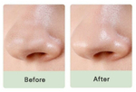 Патчи от черных точек для носа Mizon Pore Fresh Clear Nose Pack