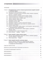 Анализ диагностических моделей челюстей