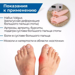 Бурсопротектор с перфорацией и гибким разделителем, цвет телесный 2 шт.