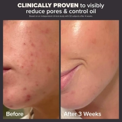 PaulasChoice Mini Skin Perfecting 2% BHA 30mL