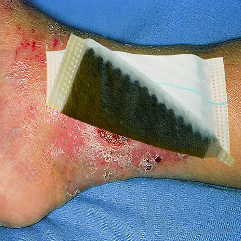 ФЛИВАКТИВ 10х10см,20штПОВЯЗКА С АКТИВИРОВАННЫМ УГЛЕМ