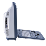 УЗИ аппарат SonoScape S2