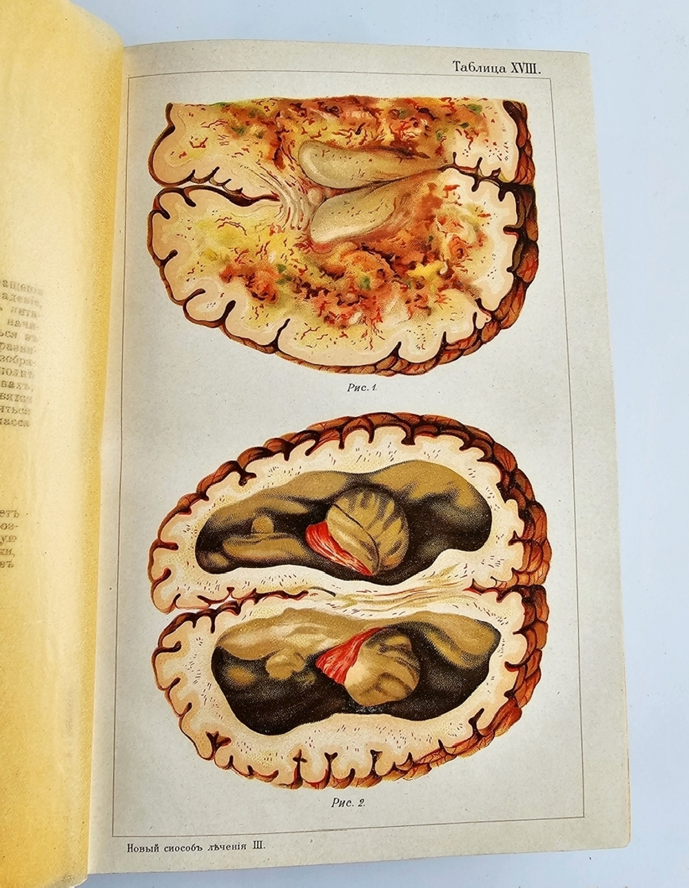 "Новый способ лечения. Лечение целебными силами природы."  М. Платен. 1906 г.