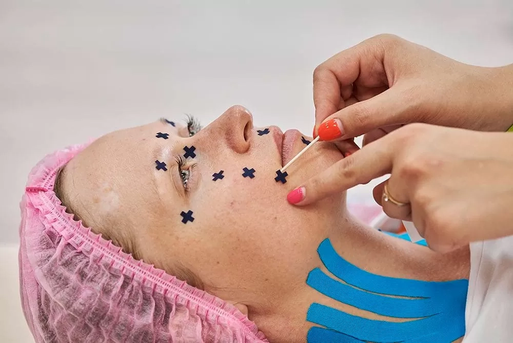 Аку тейпы BB ACU TAPE 1х1 cм бежевый