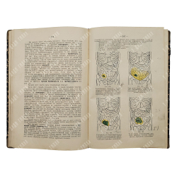Кервен Ф. [Dr. de Quervain] Частная хирургическая диагностика для студентов и врачей, 1911.