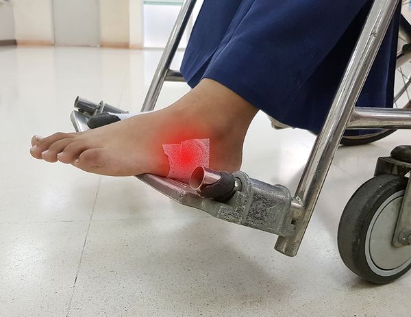 Диабетическая остеоартропатия – причины и признаки. Часть 1