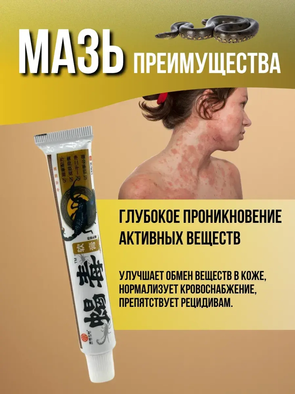 Мазь от лишая