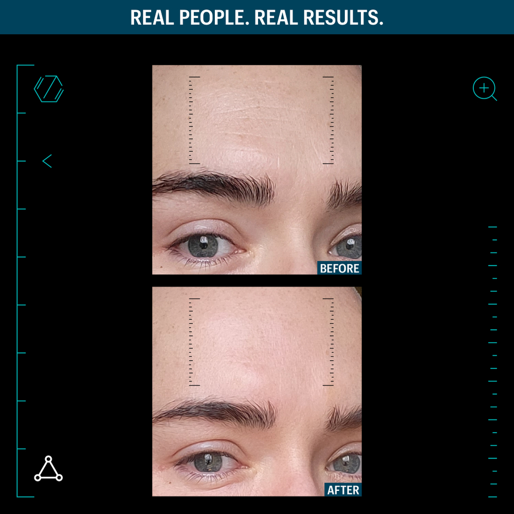 ALLIES OF SKIN Multi Peptides & GF Advanced Lifting Serum Разглаживающая мультипептидная сыворотка с фактором роста, 50 мл
