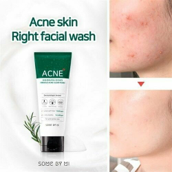 Some By Mi очищающая пенка AHA-BHA-PHA 30 days miracle acne, 100 мл, 120 г