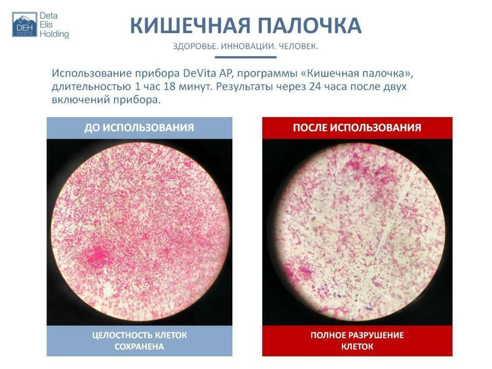Устройство "DeVita AP + " модель "Mini"