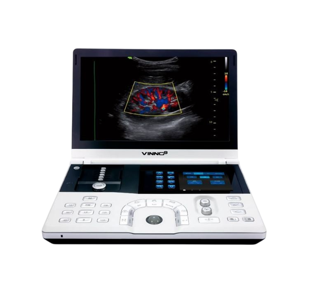 Портативный УЗИ аппарат VINNO 8