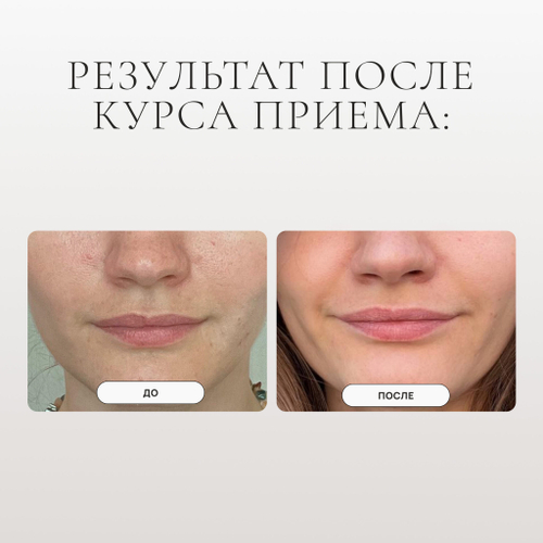 PROBIOLAB COLLAGEN (FISH) LIQUID Морской коллаген (рыбий)  питьевой 500 мл