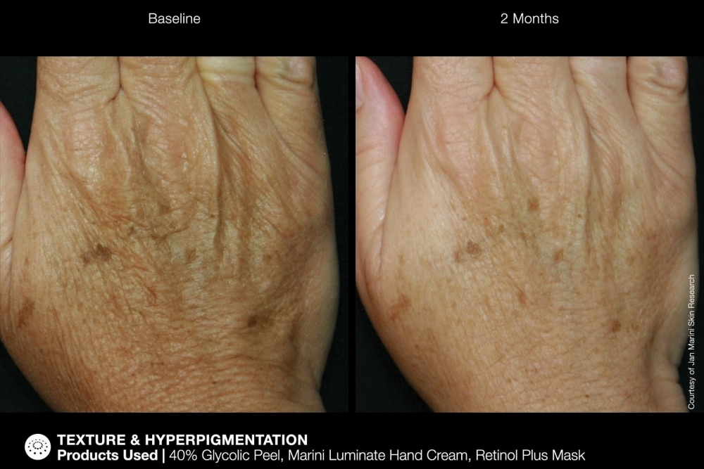 JAN MARINI RENU CORRECTIVE HAND COMPLEX Антивозрастной корректирующий крем для рук
