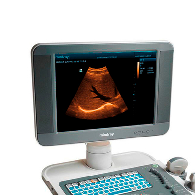 УЗИ аппарат Mindray DP-5