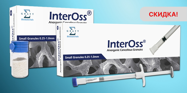 InterOss со скидкой при единовременном заказе 10 штук