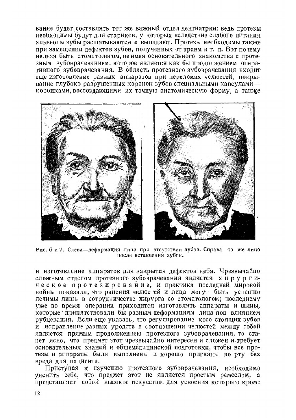 Основы протезного зубоврачевания | Е.М. Гофунг