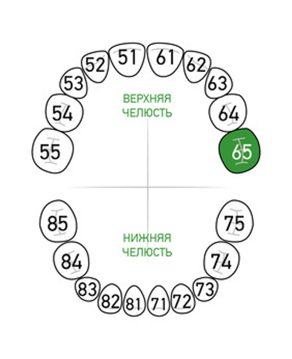 Зона применения клампа для коффердама/раббердама №65 для молочных зубов KSK Dentech (Япония)