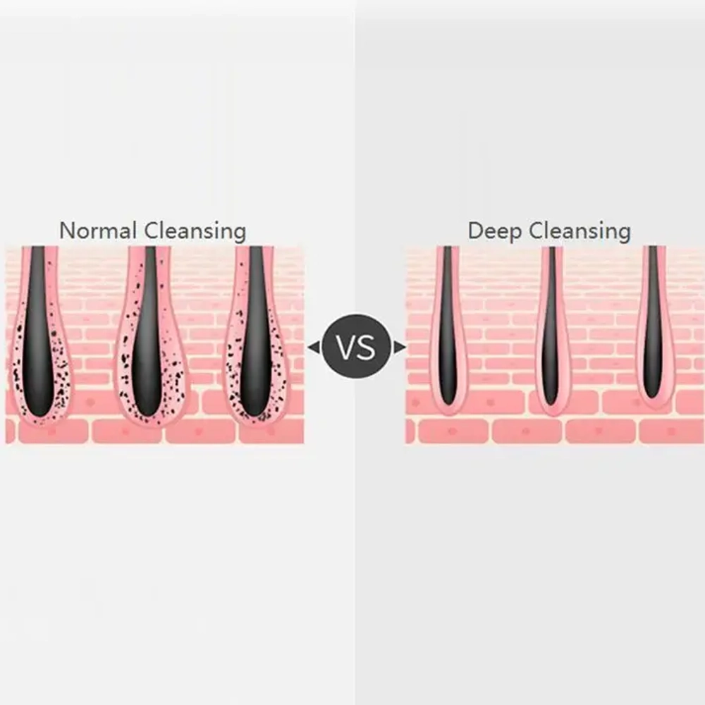 Ультра звуковой очиститель массажер для лица Xiaomi BOMIDI FC1 (Light Pink)