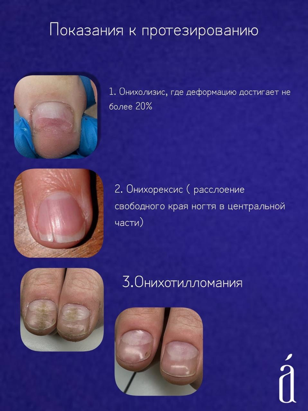 Маникюрный набор система Протез (3 компонента)