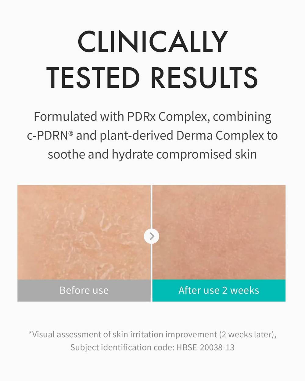 REJURAN Глубоко увлажняющий антивозрастной крем для лица с c-PDRN , 60 мл