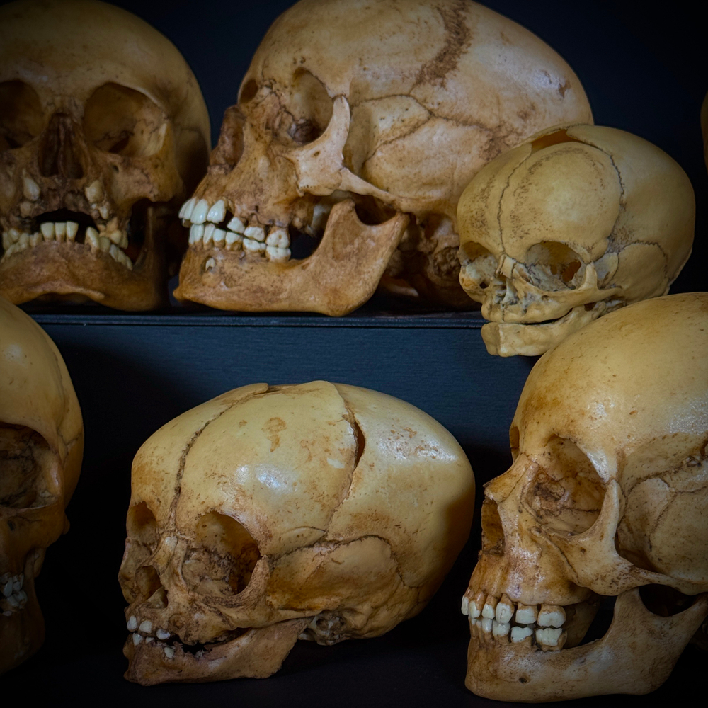 Набор «Череп человека» (анатомические модели)