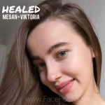 MEGAN