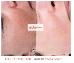 Бустер для антикуперозной терапии