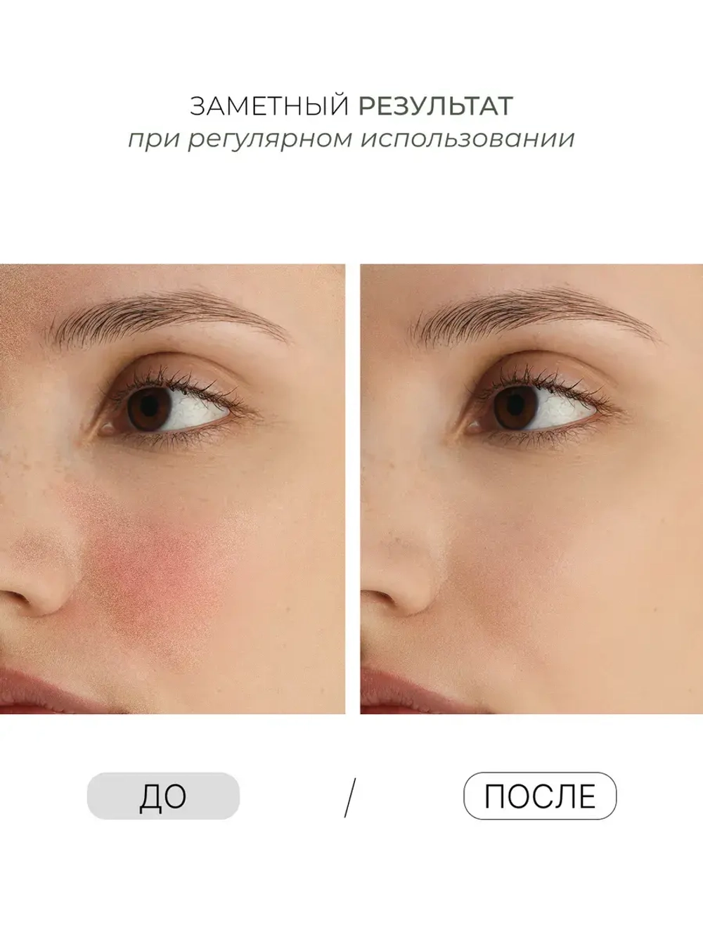 Восстанавливающий тоник с липосомами