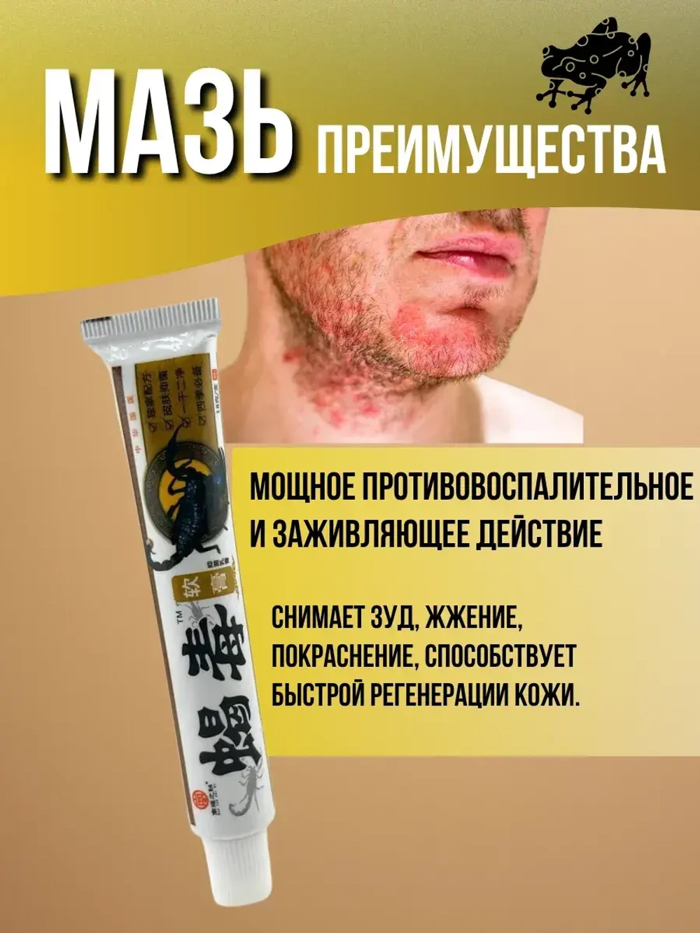 Мазь от лишая