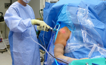 Артроскопия плечевого сустава