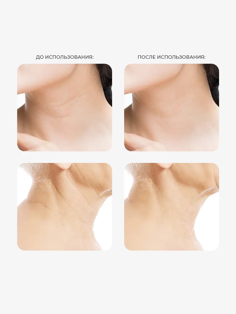 Arocell Регенерирующий антивозрастной крем для шеи и декольте с PDRN Super Neck Cream 80 гр