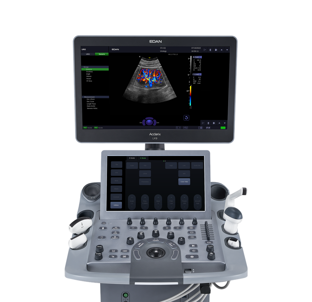 УЗИ аппарат Edan Acclarix LX8