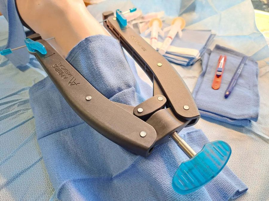 От концепции до коммерциализации за четыре месяца: Как Arbutus Medical использовала 3D-печать для быстрой разработки устройств