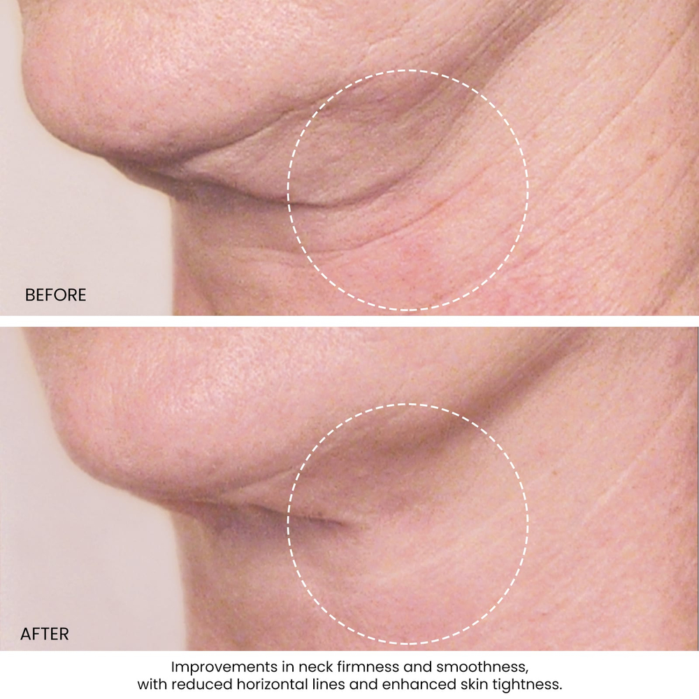 Kleem Organics, подтягивающий крем для шеи и декольте, для всех типов кожи, 50 мл (1,7 жидк. унции)