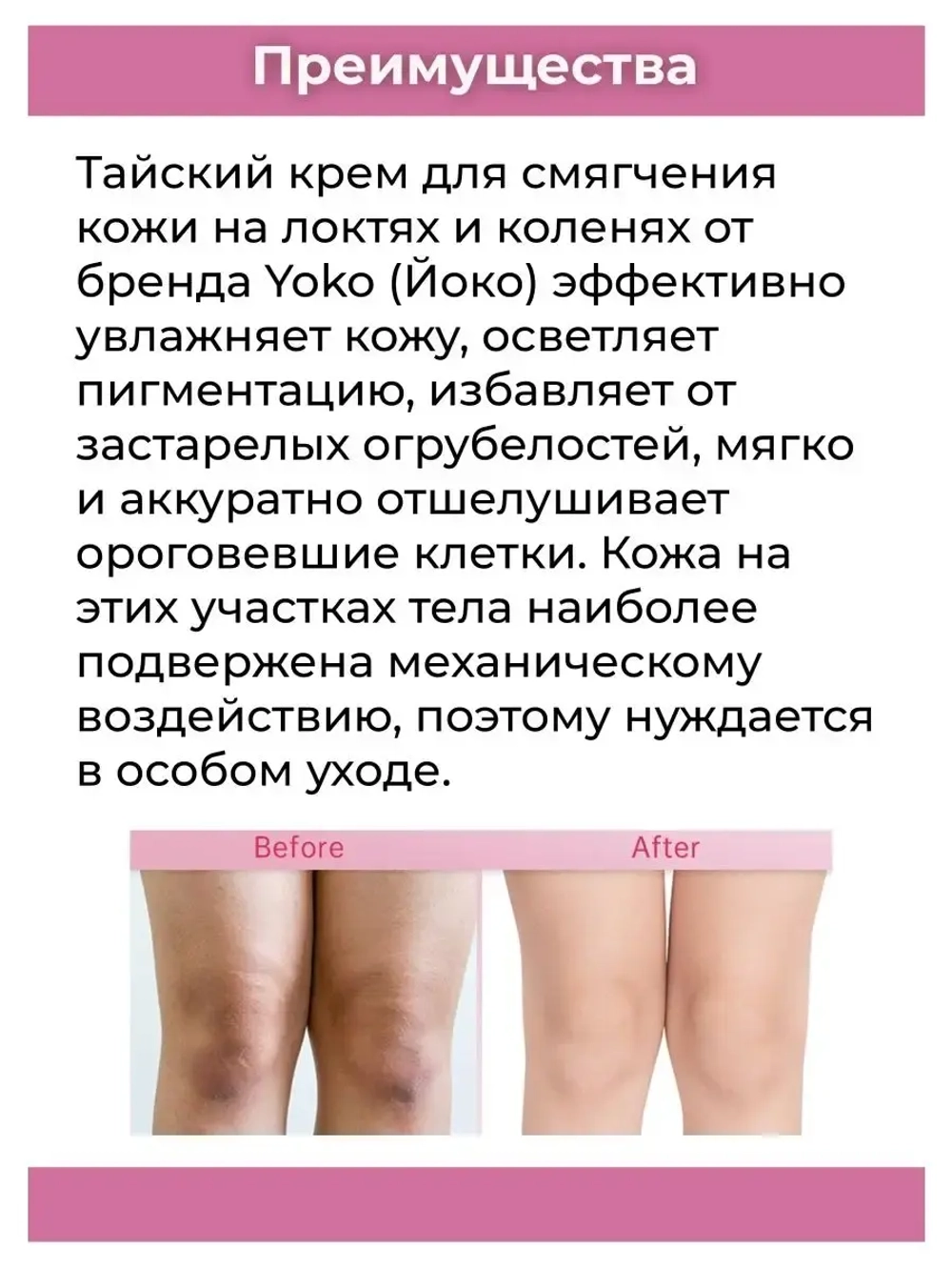 Тайский осветляющий крем для локтей.